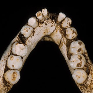 Ancient Teeth