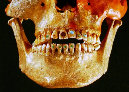 Mayan Dental Bling