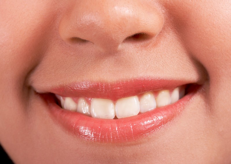 Tips to Whiten Teeth