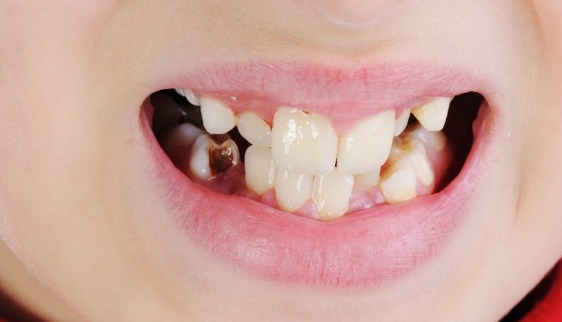 Dental Health Clues