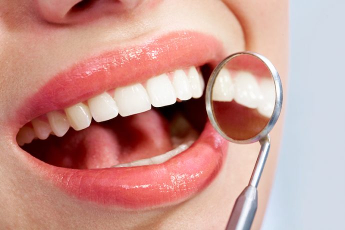 reduce teeth staining